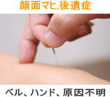 ��ʃ}�q�A�������